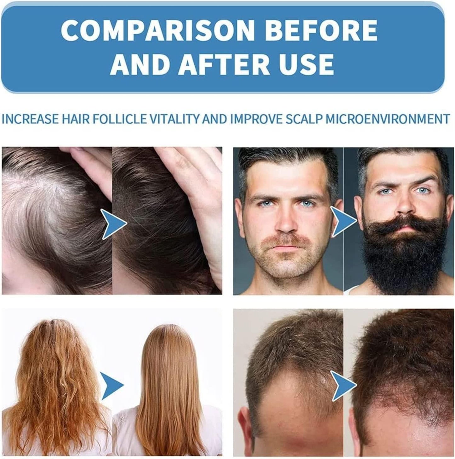 Roll On Hair Growth Serum For Women & Men (Pack of 2)
