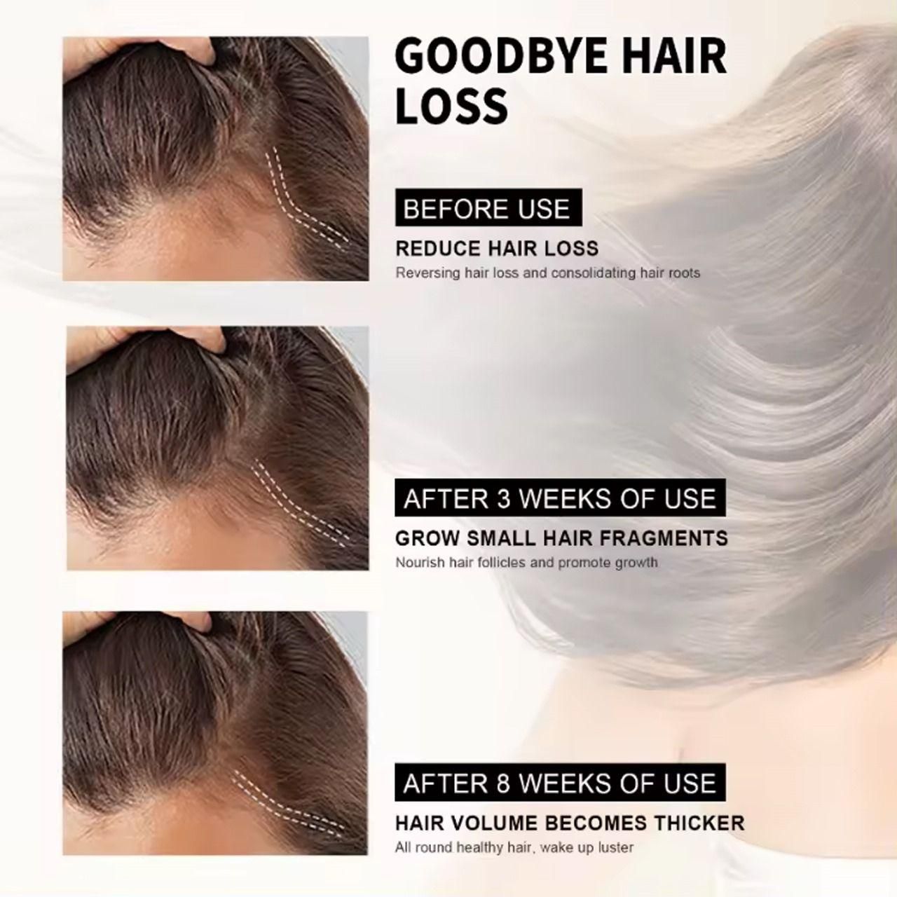 Hair Loss Treatment Serum Made of 34 Ingredients & 15 Herbs 30ml (Pack Of 2)