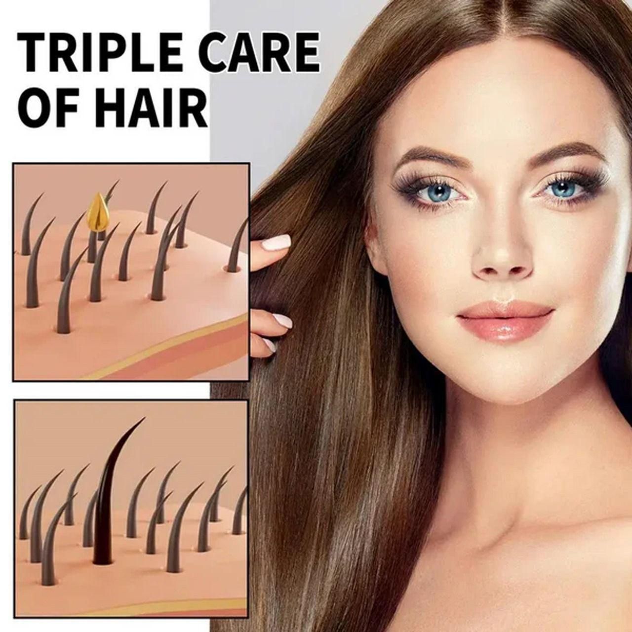 Hair Loss Treatment Serum Made of 34 Ingredients & 15 Herbs 30ml (Pack Of 2)