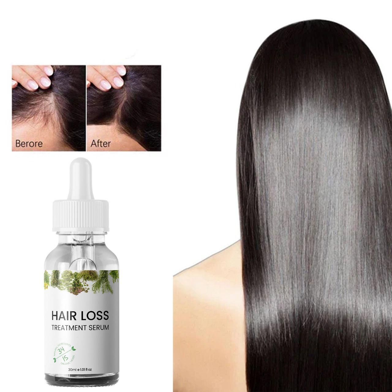Hair Loss Treatment Serum Made of 34 Ingredients & 15 Herbs 30ml (Pack Of 2)